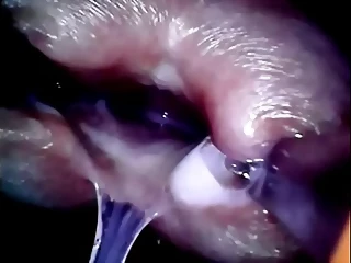 POV Syringe Diam Full Inside Cock Baguettes Ejac Cum Nsertion